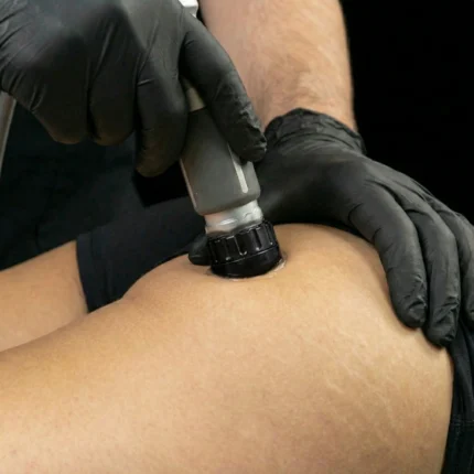 MG Beauty Clinic - Immagini Sito Shop - Onde D'Urto Glutei