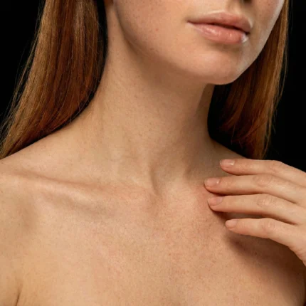 MG Beauty Clinic - Immagini Sito Shop - Bioristrutturazione Decollete