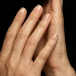 MG Beauty Clinic - Immagini Sito Shop - Bioristrutturazione Mani