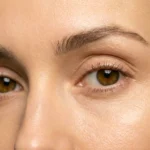 MG Beauty Clinic - Immagini Sito Shop - Biorivitalizzazione Perioculare